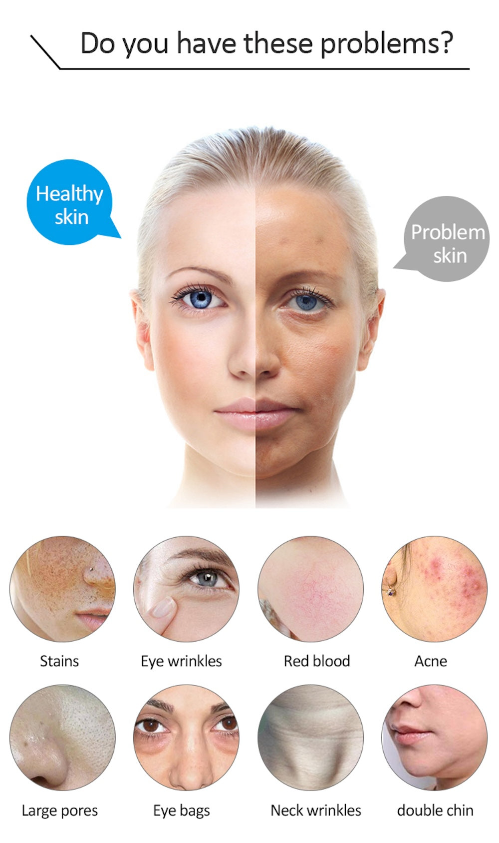 IPL OPT E-light RF 2 in 1 Permanent Hair Removal Epilator E-light Skin Rejuvenation RF Wrinkle Removal Skin Whitening