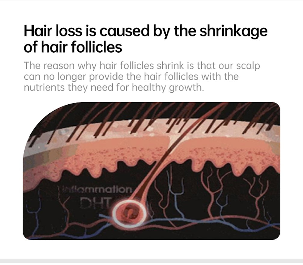 Scalp Care Serum Hair Regrowth Essence Anit-loss Hair