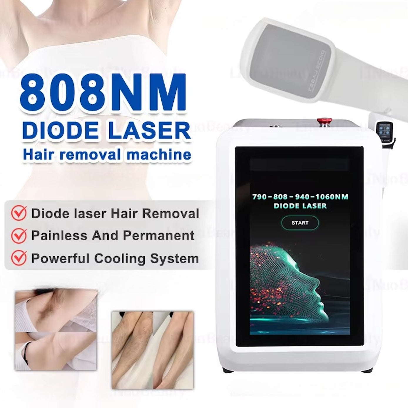 Hair Removal Diode Laser Device 810nm Laser Hair Removal 755nm/808nm/940nm/1064