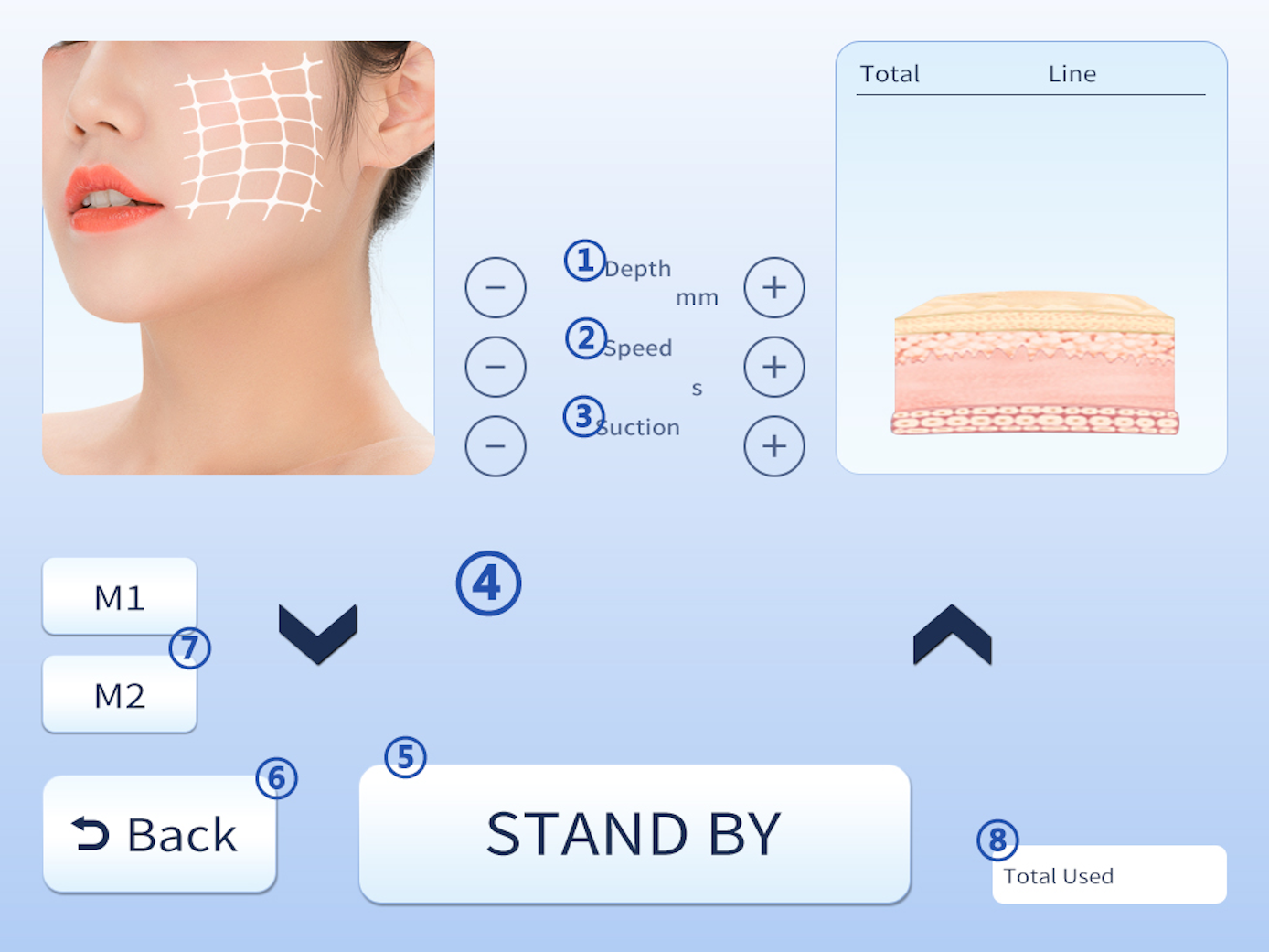 5in 1 Anti-aging Machine Hifu RF Miconeedle Liposonix Vmax Skin Lifting Body Slimming