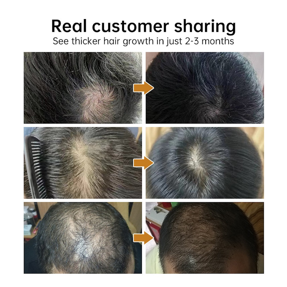 Hair Growth Ampoule Essence Caffeine Hair Anti-hair Loss Scalp Care