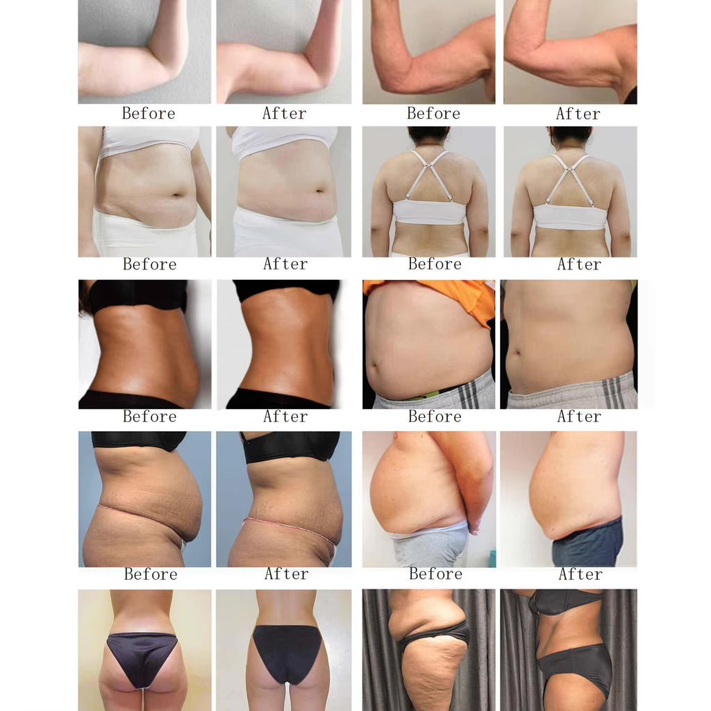 Popular 10D Maxlipo Therapy 532nm Green Light Skin Lifting Fat Burning Weight Loss Body Massage Roller Machine for Beauty Salon