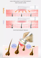 Professional Hair Growth Red Led 650nm Light Regrowth Electric Hair Care Growth Hair Scalp Care Beauty Machine