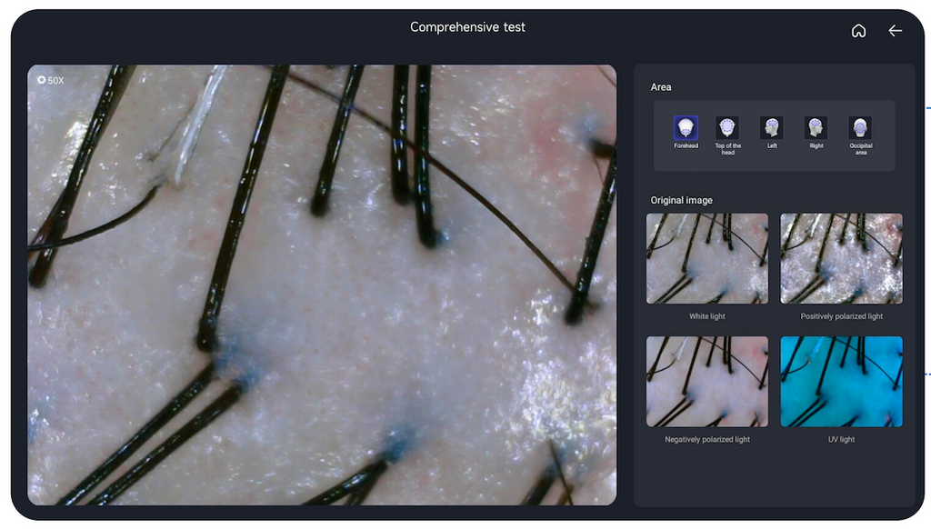 AI Smart Scalp Care Hair Analyzer 3 Detector 13 Type Analysis Indicators Beauty Salon Clinic Use