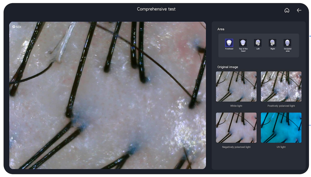 AI Smart Scalp Care Hair Analyzer 3 Detector 13 Type Analysis Indicators Beauty Salon Clinic Use