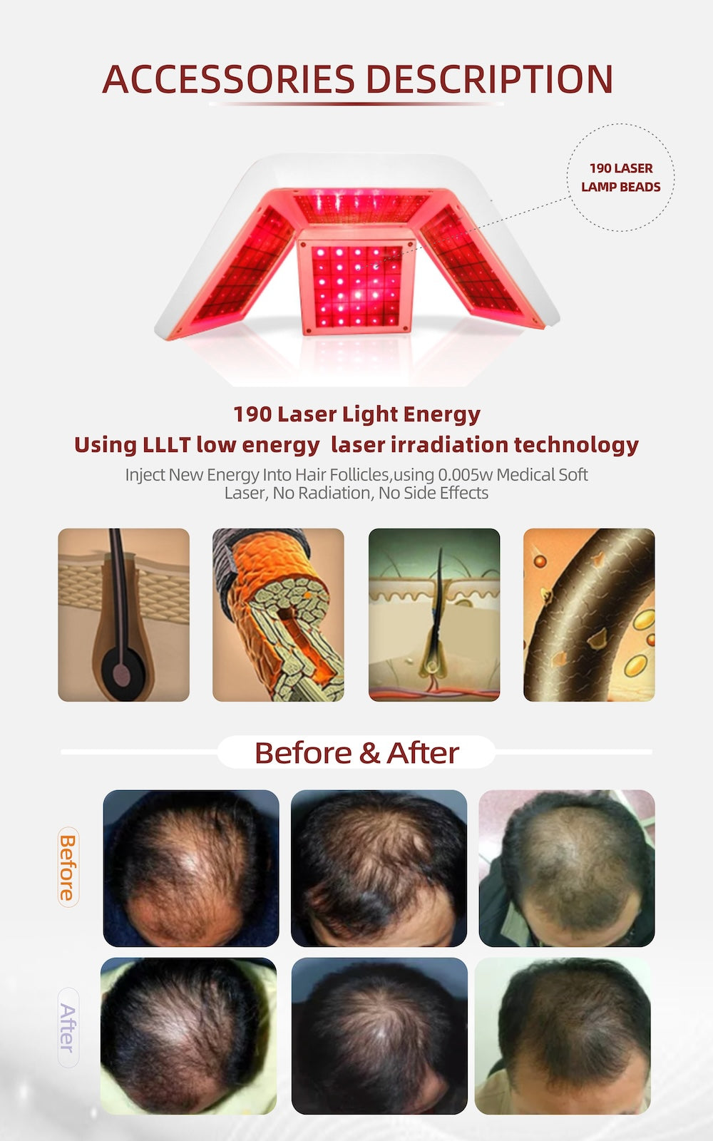 Newest Hair Loss Treatment Hair Regrowth Treatments Machine Ozone Therapy Scalp Massage Machine Receding Hairline