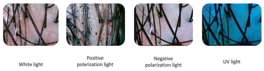 AI Smart Scalp Care Hair Analyzer 3 Detector 13 Type Analysis Indicators Beauty Salon Clinic Use