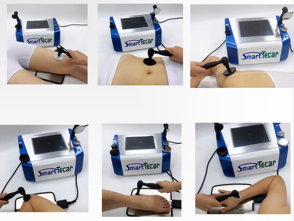 Popular Portable Body Massage Skin Firming CET-RET 448KHZ Therapy Machine Tecar Physiotherapy Pain Relief