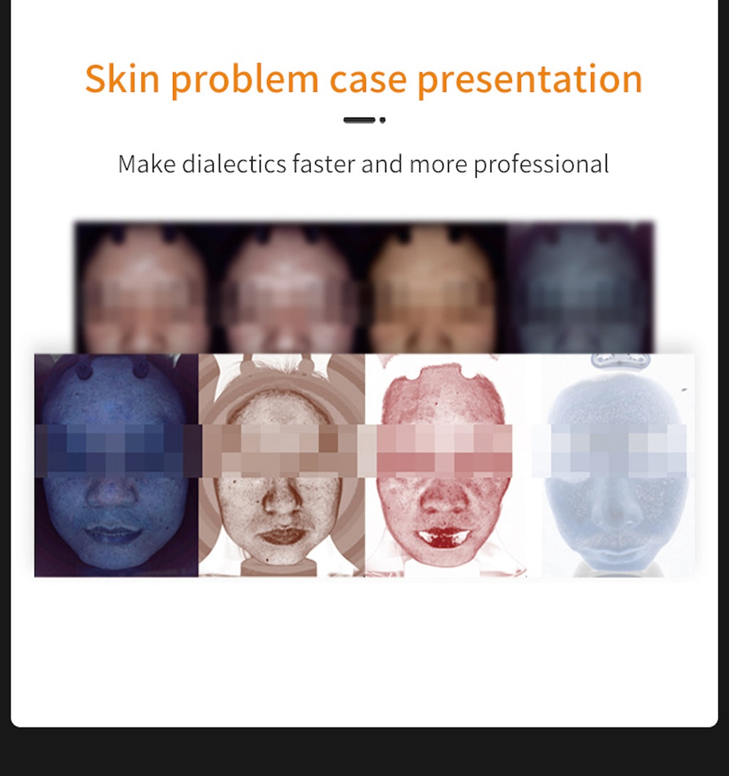 15.6 inch AI Dermatology Skin Analyzer Machine 3d Face Analysis Scanner