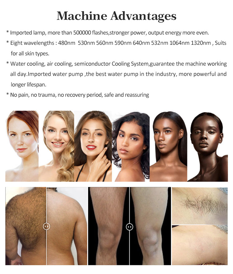 Professional RF IPL PicoLaser Tattoo Remove Machine Permanent Hair Removal E-light OPT Painless Skin Rejuvenation RF Tightening Depilator