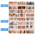 Professional RF IPL PicoLaser Tattoo Remove Machine Permanent Hair Removal E-light OPT Painless Skin Rejuvenation RF Tightening Depilator