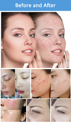 Professional RF IPL PicoLaser Tattoo Remove Machine Permanent Hair Removal E-light OPT Painless Skin Rejuvenation RF Tightening Depilator