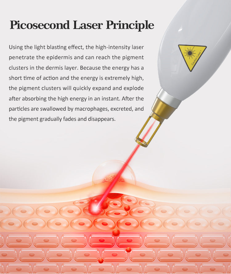 Professional RF IPL PicoLaser Tattoo Remove Machine Permanent Hair Removal E-light OPT Painless Skin Rejuvenation RF Tightening Depilator