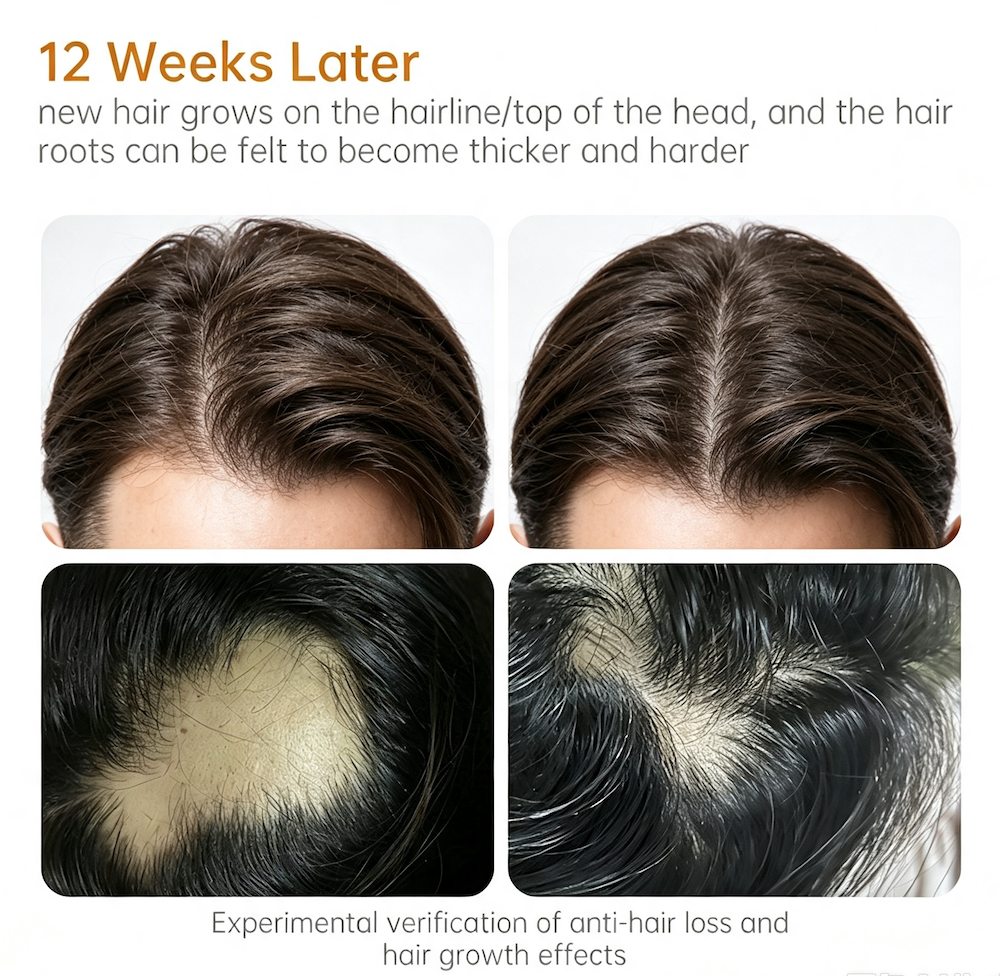 Hair Regrowth Essence Anti-hair Loss Serum 30ML