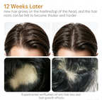 Hair Regrowth Essence Anti-hair Loss Serum 30ML