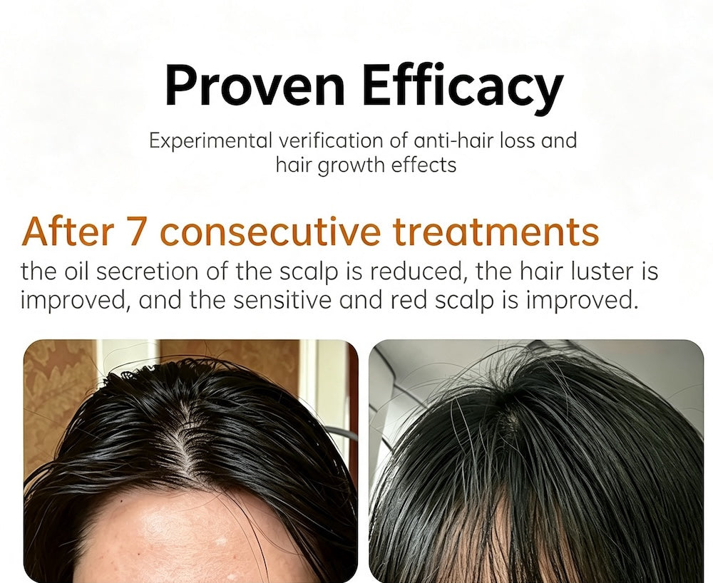 Hair Regrowth Essence Anti-hair Loss Serum 30ML