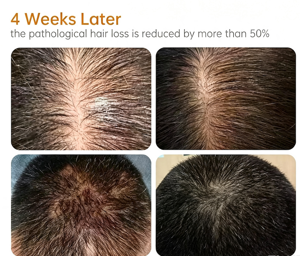 Hair Regrowth Essence Anti-hair Loss Serum 30ML