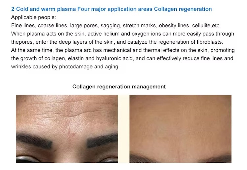 Cold Plasma Skin Care Beauty Home Use Tools Cold Plasma Instrument for Efficient Skin Rejuvenation Acne Management