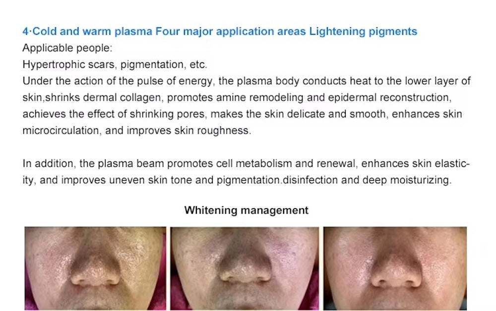 Cold Plasma Skin Care Beauty Home Use Tools Cold Plasma Instrument for Efficient Skin Rejuvenation Acne Management