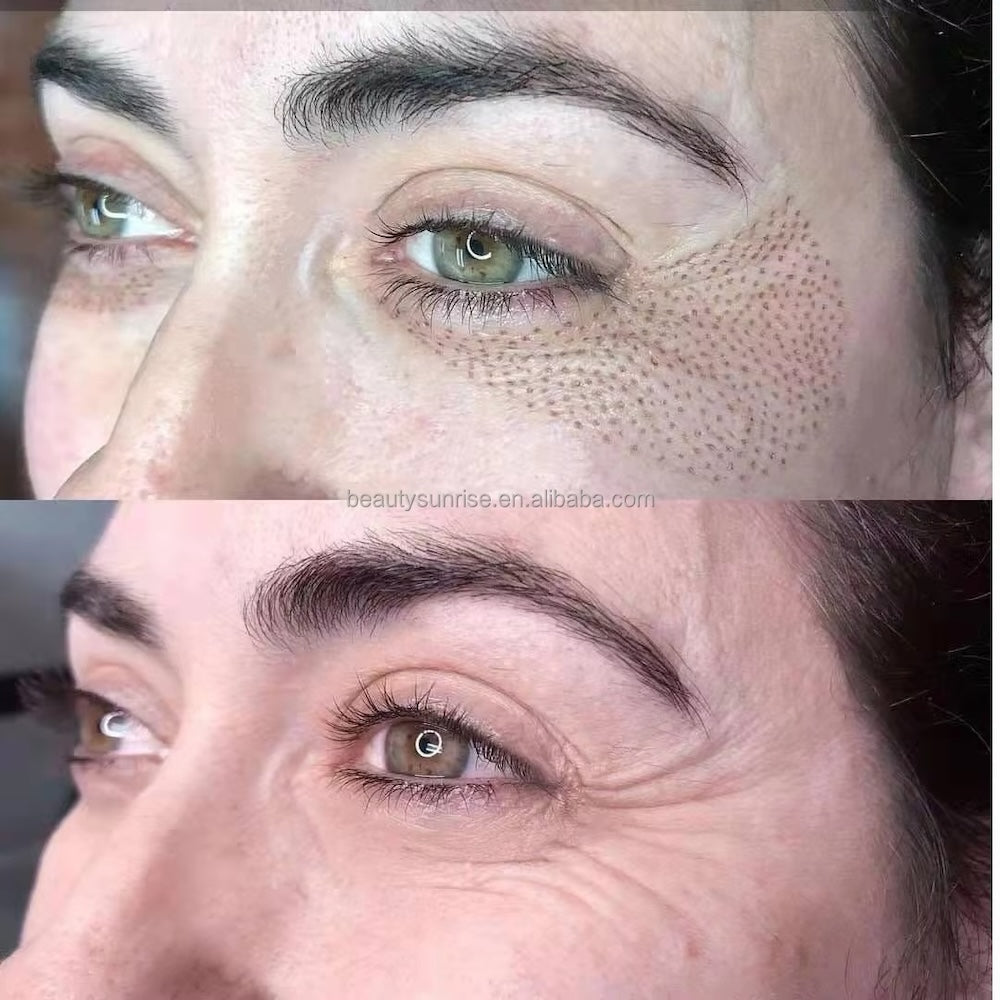 Cold Plasma Skin Care Beauty Home Use Tools Cold Plasma Instrument for Efficient Skin Rejuvenation Acne Management