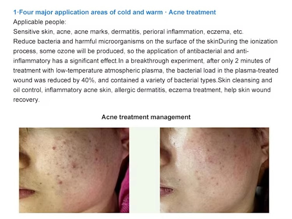 Cold Plasma Skin Care Beauty Home Use Tools Cold Plasma Instrument for Efficient Skin Rejuvenation Acne Management