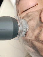 Skin Balance Black Capsule CO2 Oxygen Glowskin Pod Serum for Facial Machine Skin Rejuvenation Oil Skin Balance