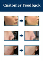 Skin Balance Black Capsule CO2 Oxygen Glowskin Pod Serum for Facial Machine Skin Rejuvenation Oil Skin Balance