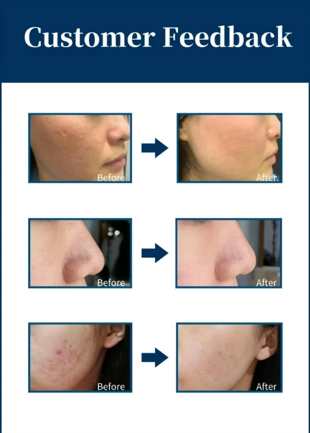 Skin Balance Black Capsule CO2 Oxygen Glowskin Pod Serum for Facial Machine Skin Rejuvenation Oil Skin Balance