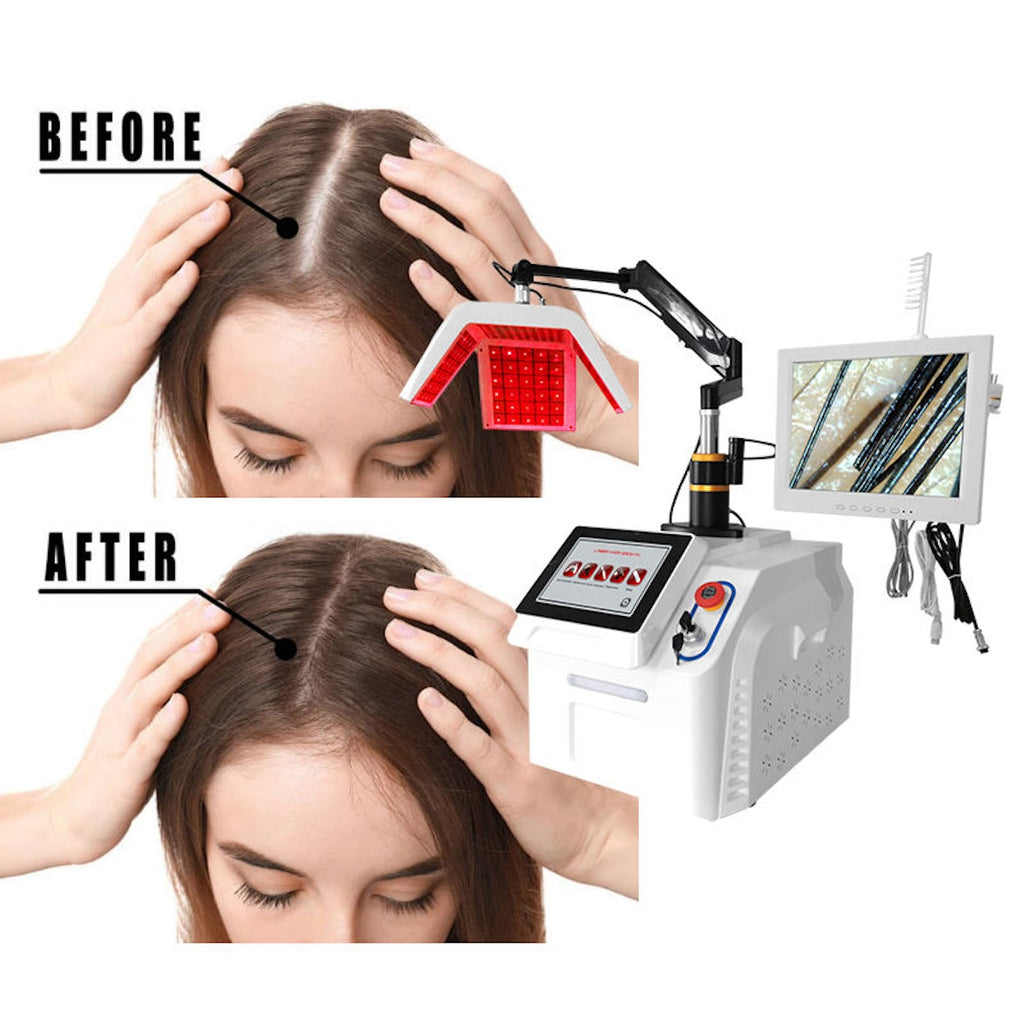 Newest Hair Loss Treatment Hair Regrowth Treatments Machine Ozone Therapy Scalp Massage Machine Receding Hairline