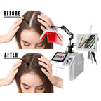 Newest Hair Loss Treatment Hair Regrowth Treatments Machine Ozone Therapy Scalp Massage Machine Receding Hairline