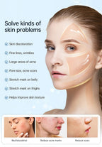 Hot Sale New H5 Hydra Pen with Serum Container Derma Micro-Needle Pen Anti-Wrinkle Wireless Derma Pen Beauty Device
