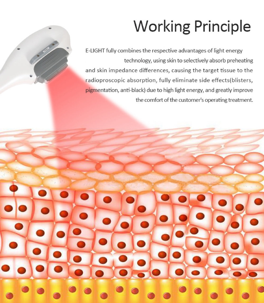 IPL OPT E-light RF 2 in 1 Permanent Hair Removal Epilator E-light Skin Rejuvenation RF Wrinkle Removal Skin Whitening