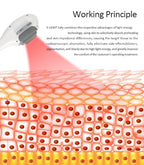 IPL OPT E-light RF 2 in 1 Permanent Hair Removal Epilator E-light Skin Rejuvenation RF Wrinkle Removal Skin Whitening