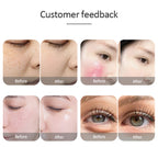 IPL OPT E-light RF 2 in 1 Permanent Hair Removal Epilator E-light Skin Rejuvenation RF Wrinkle Removal Skin Whitening