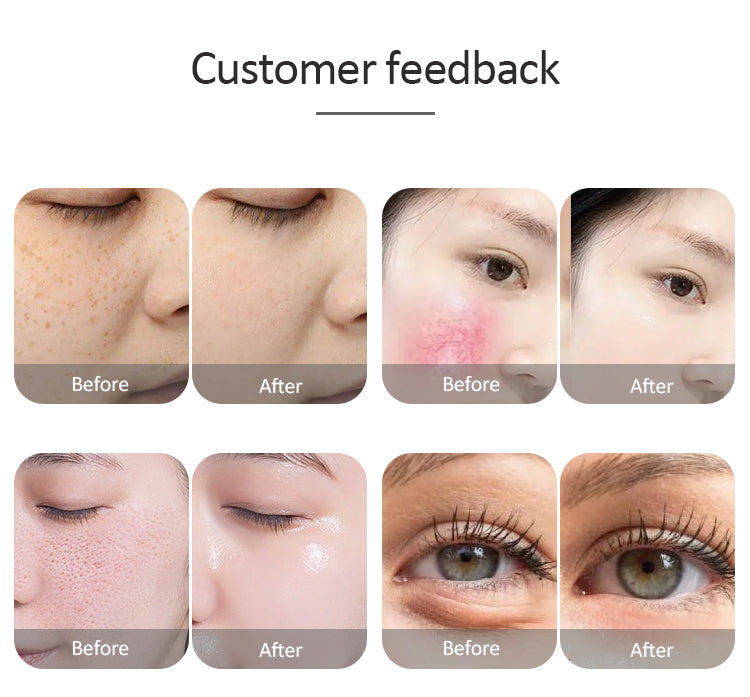 IPL OPT E-light RF 2 in 1 Permanent Hair Removal Epilator E-light Skin Rejuvenation RF Wrinkle Removal Skin Whitening