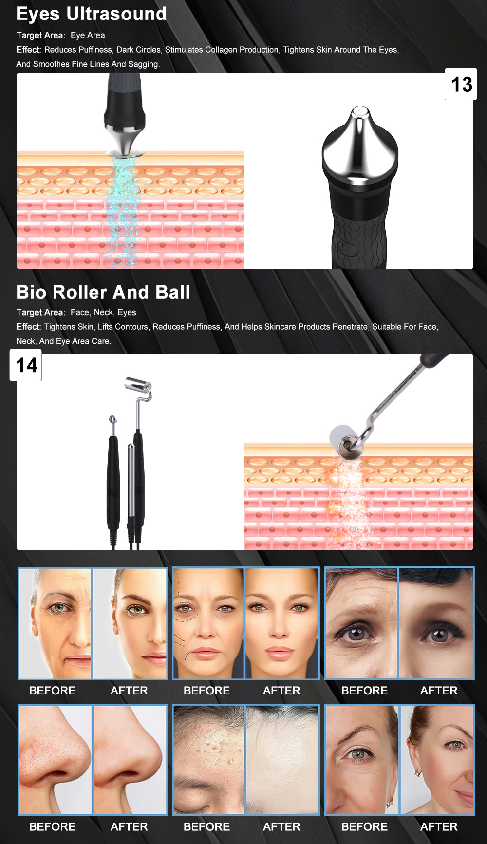 14in1  Hydra Facial Machine Microdermabrasion Diamond Peel Skin Rejuvenation RF Anti-Aging Oxygen Plasma