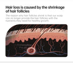 Scalp Care Serum Hair Regrowth Essence Anit-loss Hair