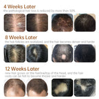 Scalp Care Serum Hair Regrowth Essence Anit-loss Hair