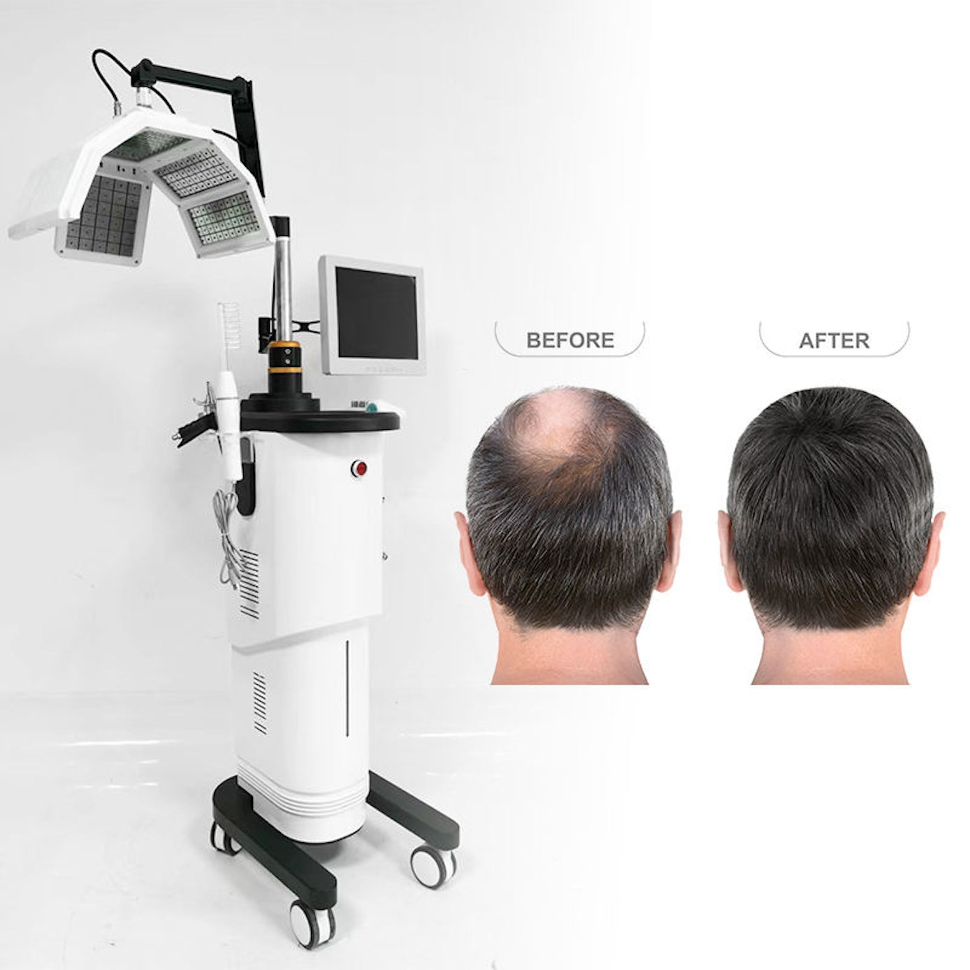 Professional Hair Growth Red Led 650nm Light Regrowth Electric Hair Care Growth Hair Scalp Care Beauty Machine