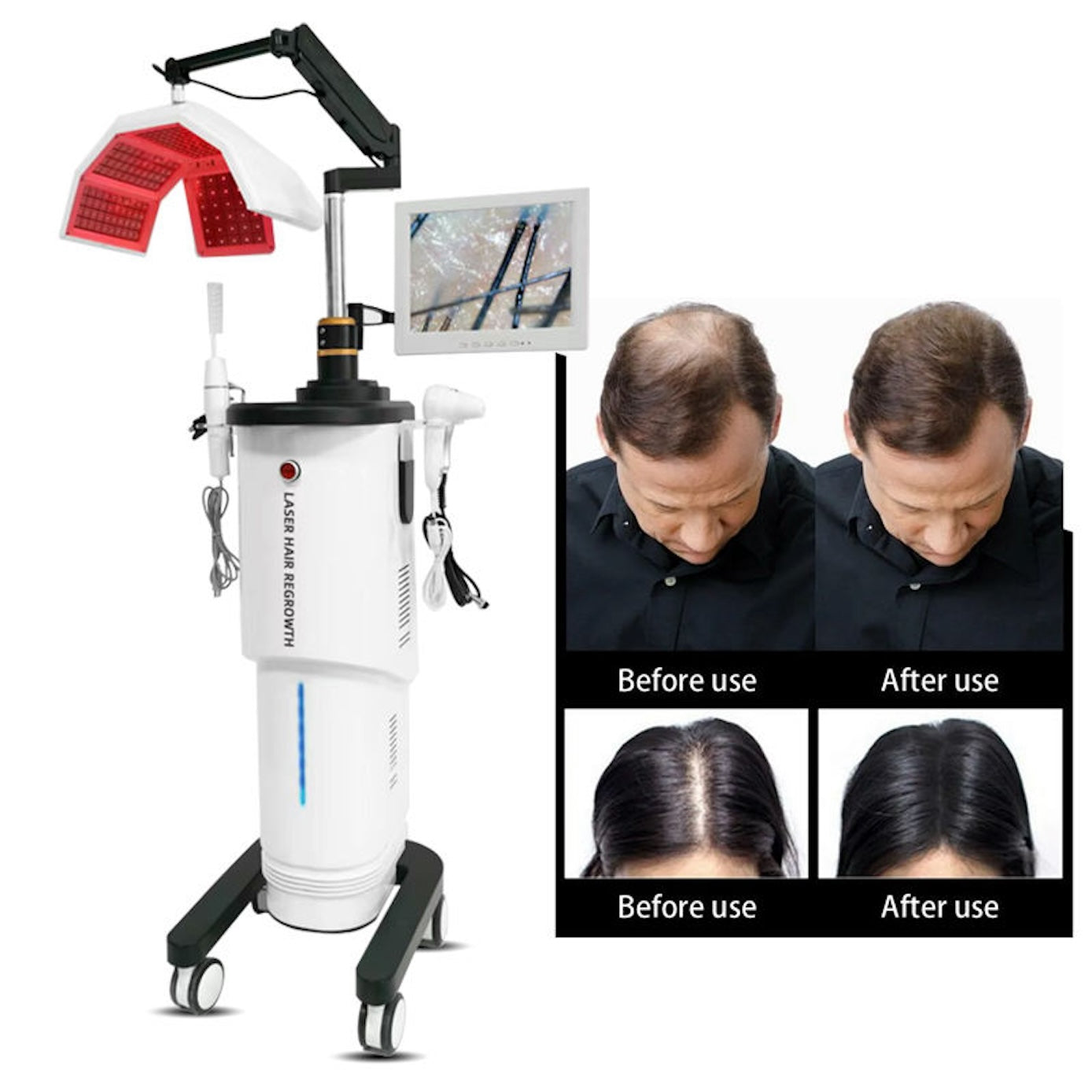 Professional Hair Growth Red Led 650nm Light Regrowth Electric Hair Care Growth Hair Scalp Care Beauty Machine
