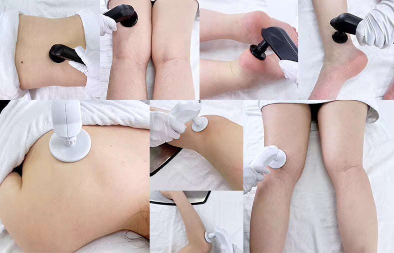 Popular Portable Body Massage Skin Firming CET-RET 448KHZ Therapy Machine Tecar Physiotherapy Pain Relief