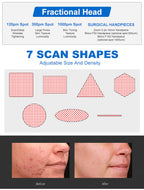 CO2 Fractional Laser Machine High Speed Stretch Mark Removal Scar Acne Treatment Vaginal Tightening