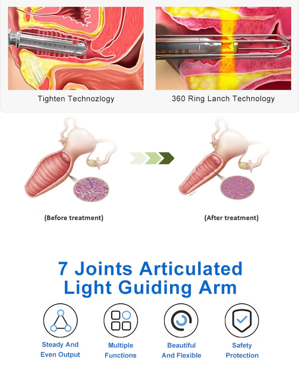 CO2 Fractional Laser Machine High Speed Stretch Mark Removal Scar Acne Treatment Vaginal Tightening