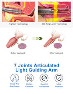 CO2 Fractional Laser Machine High Speed Stretch Mark Removal Scar Acne Treatment Vaginal Tightening