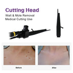 CO2 Fractional Laser Machine High Speed Stretch Mark Removal Scar Acne Treatment Vaginal Tightening