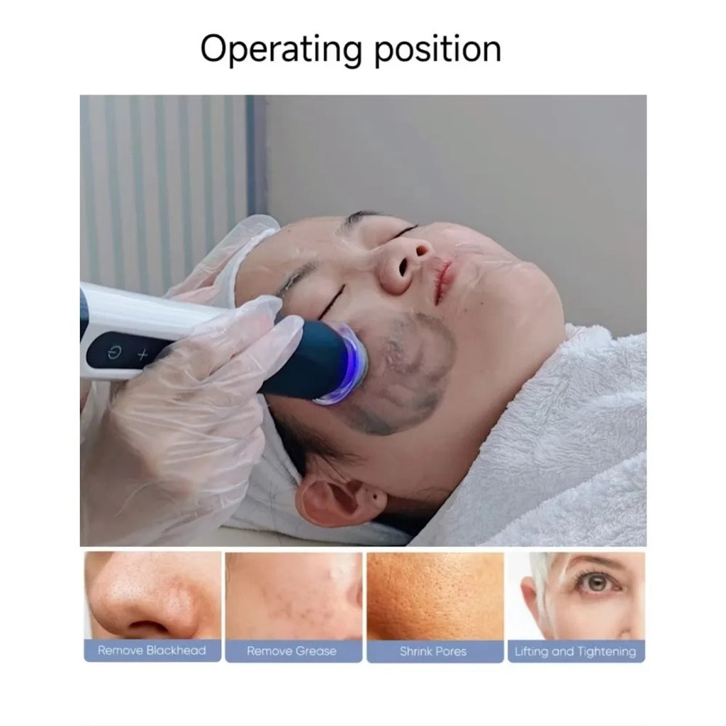 Skin Balance Black Capsule CO2 Oxygen Glowskin Pod Serum for Facial Machine Skin Rejuvenation Oil Skin Balance