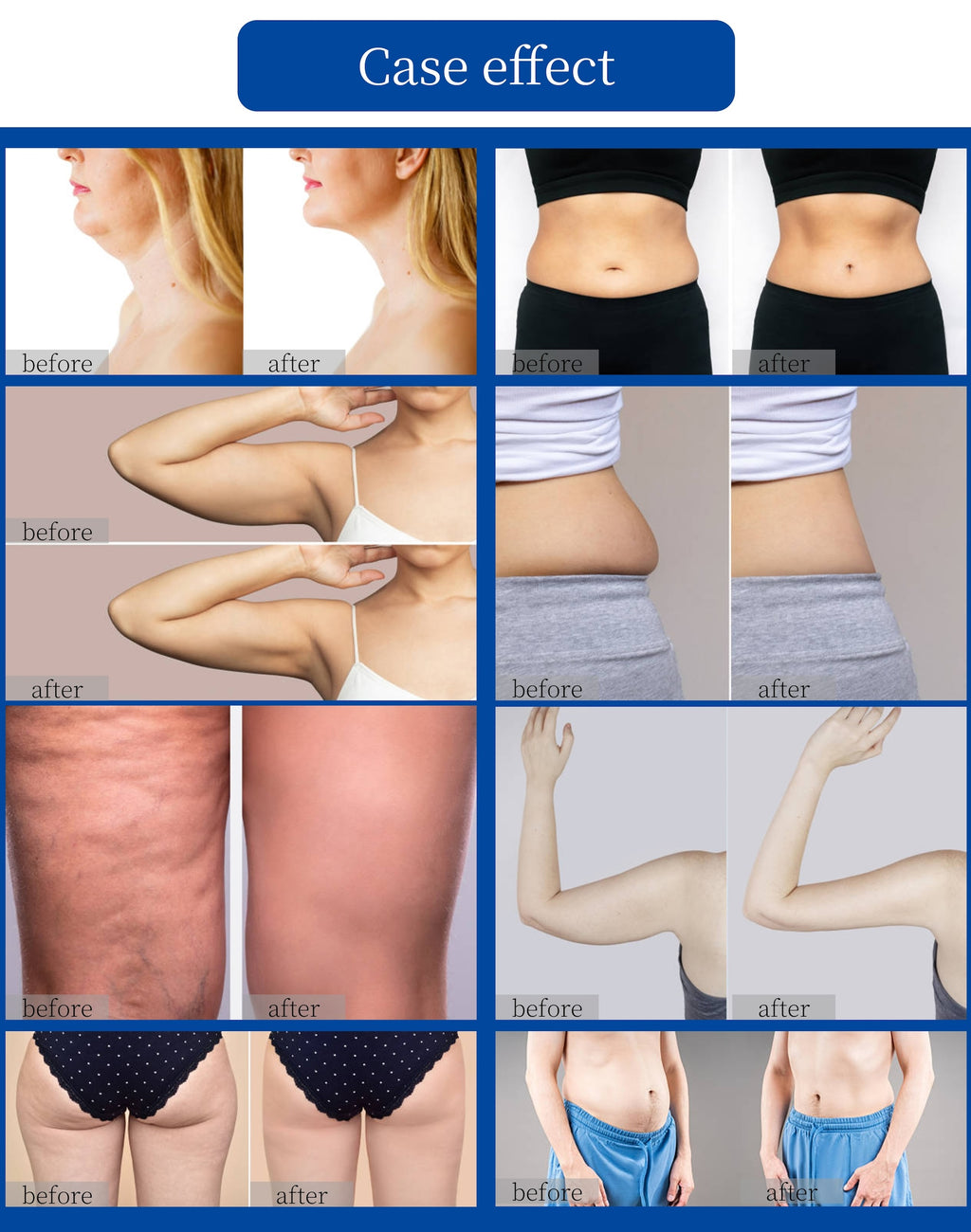 3 Handle 2.45GHz Standing Body Slimming Machine Face Lifting Fat Reduction Salon Use