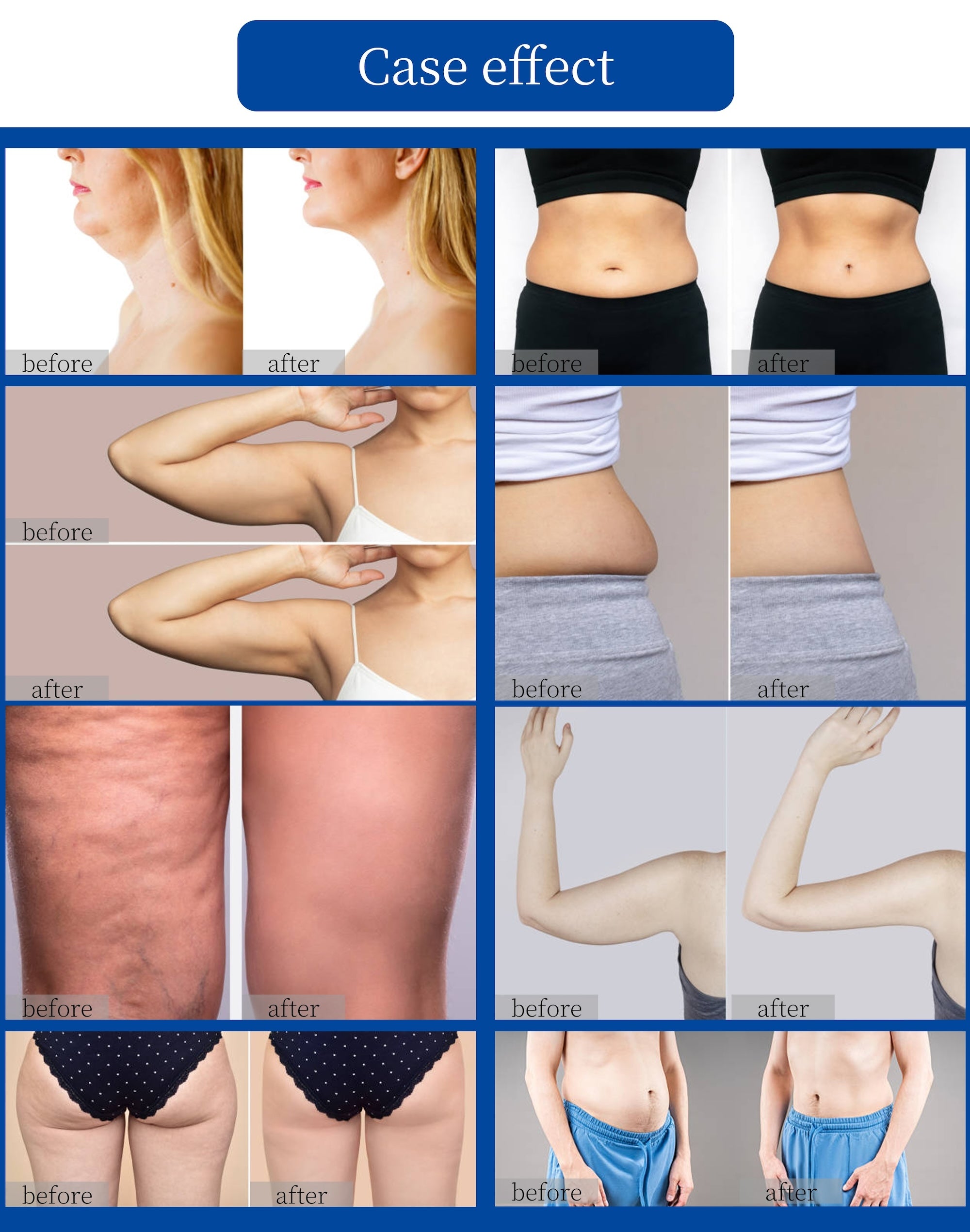 3 Handle 2.45GHz Standing Body Slimming Machine Face Lifting Fat Reduction Salon Use