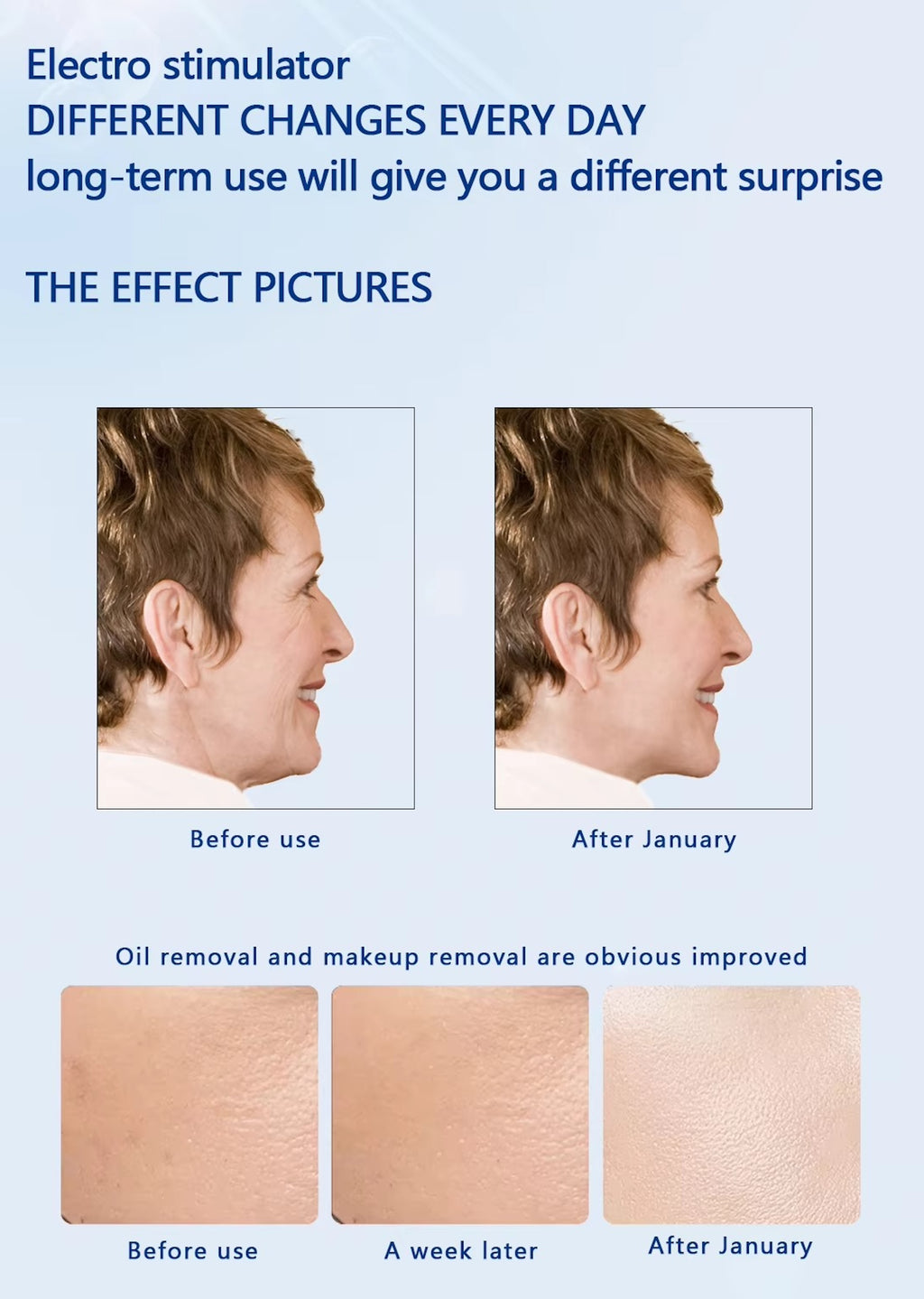 Hot Selling Home Use Effectively Introduce Skin Care EMS Product Guided Dermo Electro Proration Non-Invasive Beauty Machine