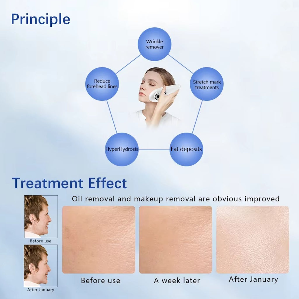 Hot Selling Home Use Effectively Introduce Skin Care EMS Product Guided Dermo Electro Proration Non-Invasive Beauty Machine